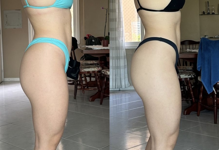 Resultado antes e depois