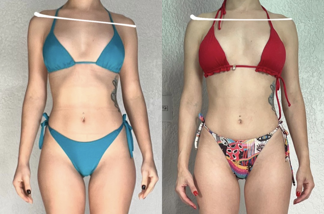 Resultado antes e depois