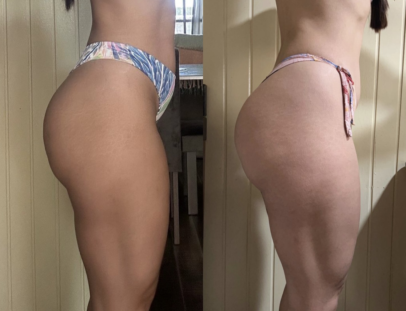 Resultado antes e depois